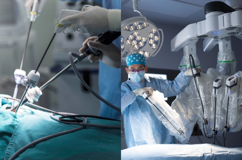 Advances and Benefits in Laparoscopic and Robotic Surgery