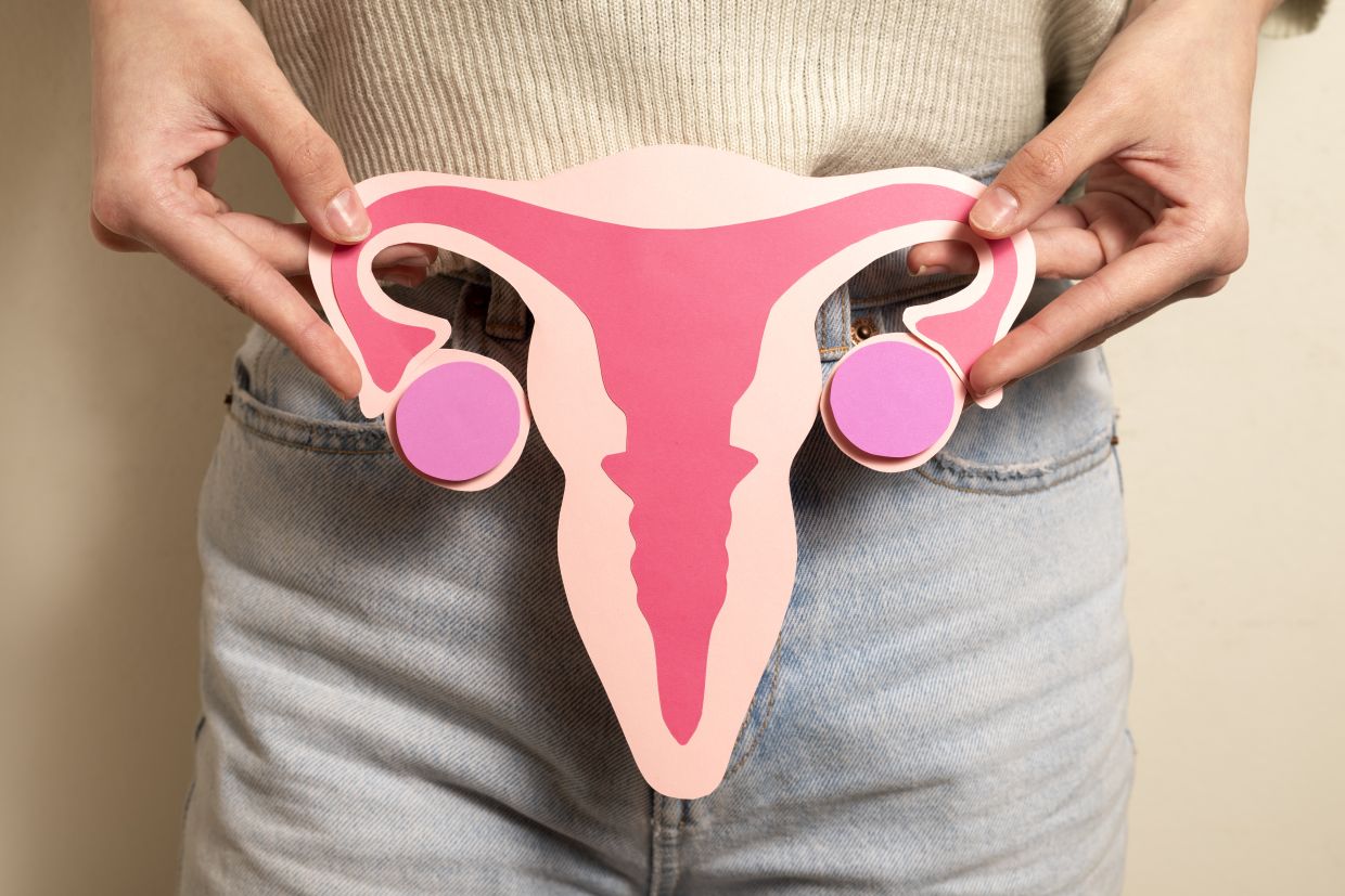 Illustration of endometriosis condition