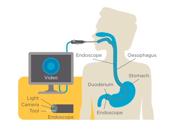 Upper GI tract illustration