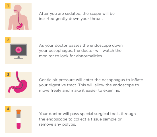 During procedure illustration