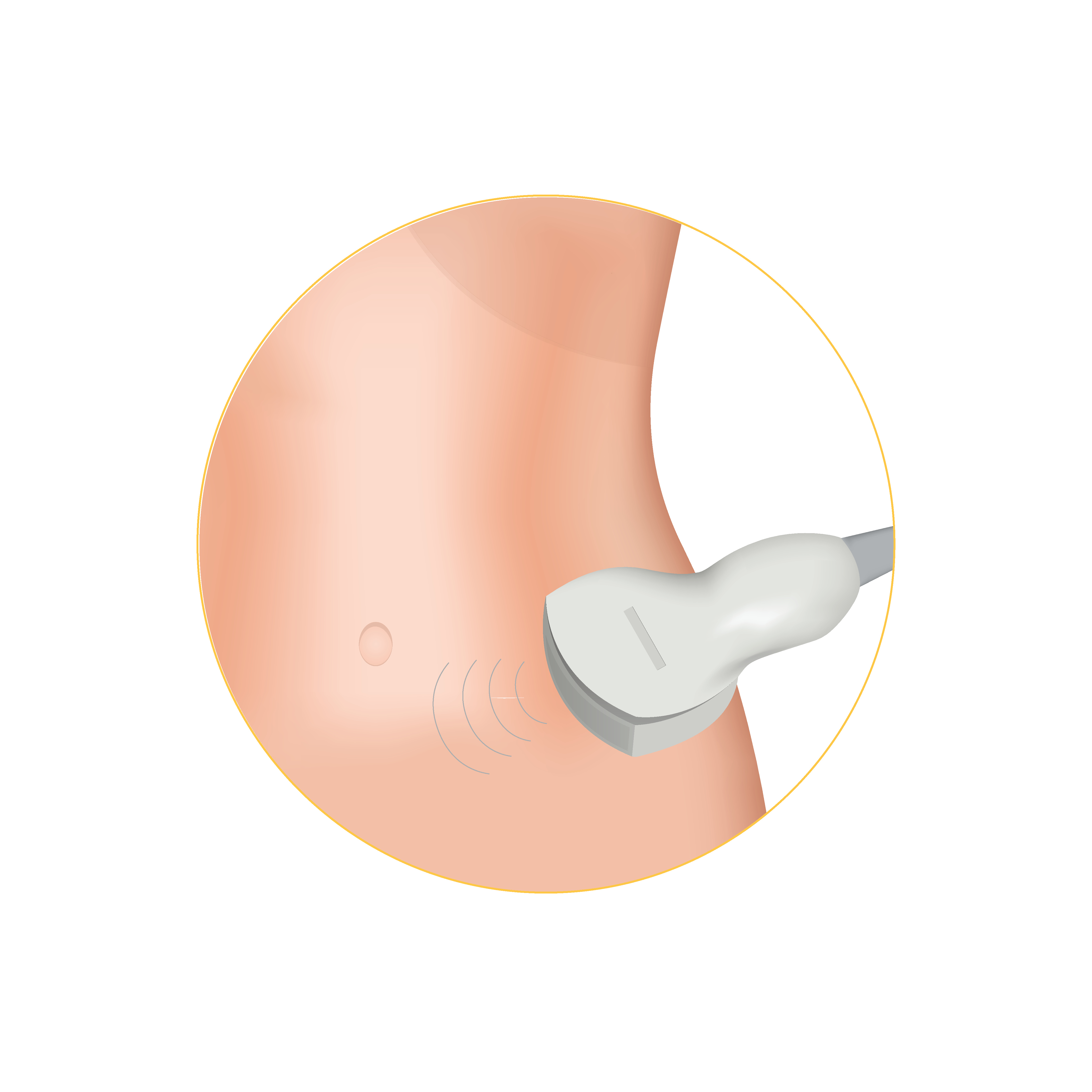 Imaging for Microwave Ablation