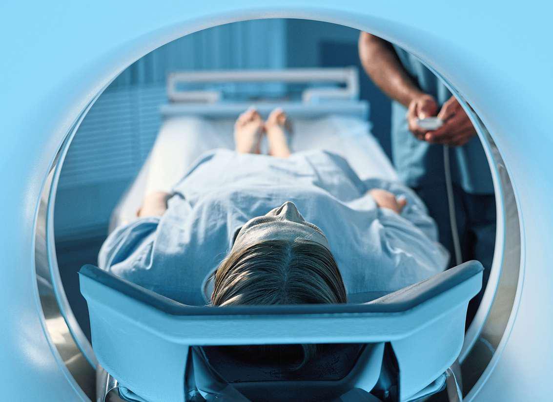 Medical illustration of ovarian cancer awareness